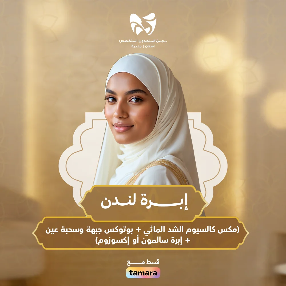 إبــــــــــرة-لندن