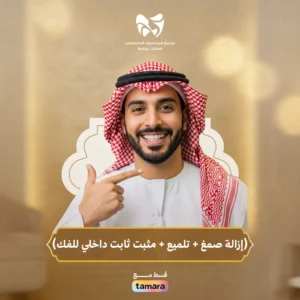 إزالة صمغ + تلميع +مثبت ثابت داخلي للفك