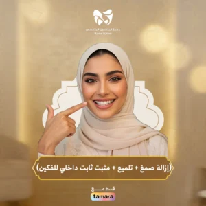 إزالة صمغ + تلميع + مثبت ثابت داخلي للفكين