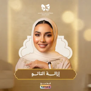 إزالة التاتو