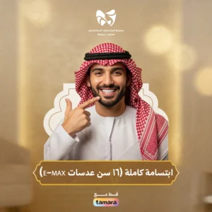 ابتسامة كاملة (16 سن عدسات E-MAX)